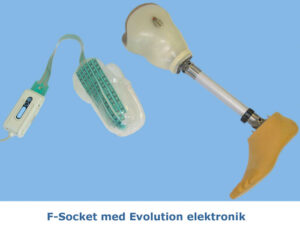 Tekscan tryckmätning för tryck och tryckfördelning i proteser