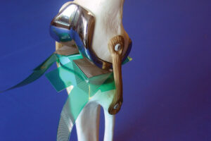 Tekscan K-Scan tryckmätning för ledfunktionsanalys